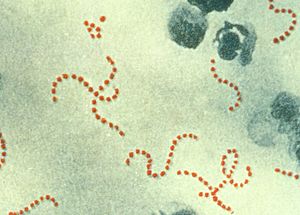 streptokokkos